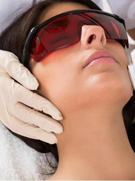 face-laser-treatment service