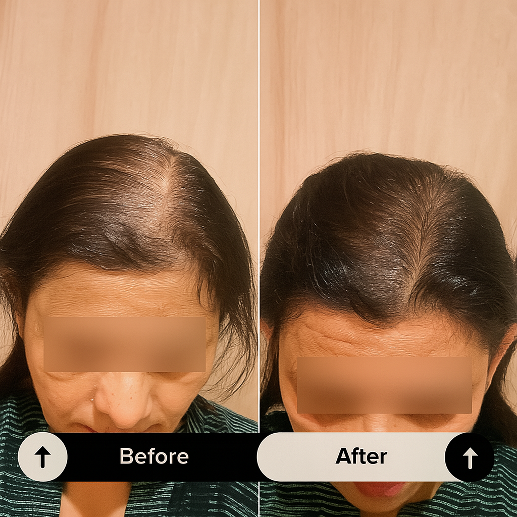 before after 03